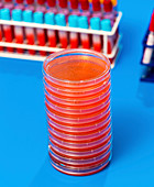 Biological samples in a lab