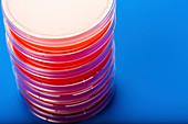 Petri dishes with blood agar