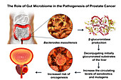 Gut microbiome and prostate cancer, conceptual illustration