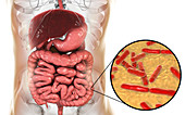 Bifidobacterium bacteria in human intestine, illustration