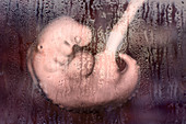 Abortion, conceptual illustration