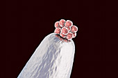 Human blastocyst on a pin tip, conceptual illustration