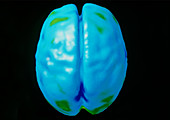 Coloured 3-D PET scan of the brain at rest