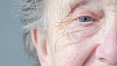 Elderly woman's eye