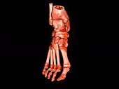 Human ankle and foot bones, rotating 3D CT scan