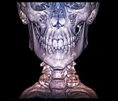 Human skull and cervical spine, 3D CT scan
