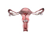 Cervical cancer, illustration