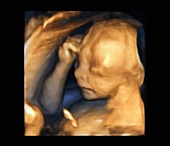 Foetus at 20 weeks, 3D ultrasound scan