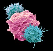CAR T-cell immunotherapy, SEM
