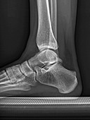 Human foot and ankle, lateral X-ray
