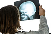 Doctor examining X-ray of the skull