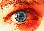 Human eye implant, illustration