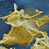 Endotoxin von Escherichia coli Bakterien