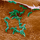 Helicobacter pylori bacteria