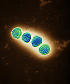 Francisella bacteria, TEM