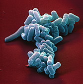 EHEC 10000x - EH E coli