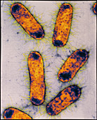 Coloured TEM of Escherichia coli bacteria