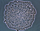 E. Coli, Teilung A 1 - E Coli, Teilung A