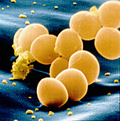 SEM of staphylococcus aureus bacteria