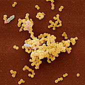 Staphylo aureus 4800x - Staphylococcus aureus 4800x