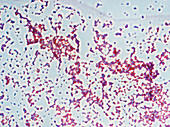 Staphyloc aureus PH 400x - Staphylococcus aureus 400x