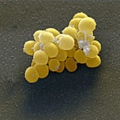 Staphylo aureus 20000x - Staphylococcus aureus 20000x
