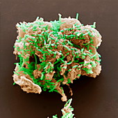 Uranium waste bacteria, SEM