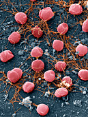 Pyrococcus furiosus archaea, SEM