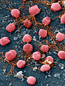 Pyrococcus furiosus 9000x - 