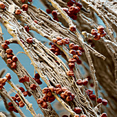 Rust fungus, SEM