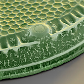 Diatomee Eupodiscus 3000x - 