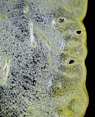 Lemon fruit, light micrograph