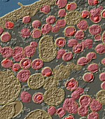 Chlamydia trachomatis bacteria, TEM