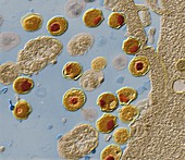 Chlamydia trachomatis bacteria, TEM