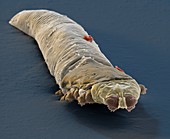 Eyelash mite, SEM