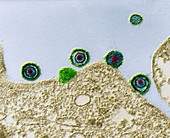 Herpes simplex virus particles, TEM