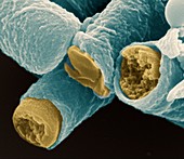 Bac anthr Sporen 60kx - Bakterien, Bacillus anthracis, Sporen 60 000-1