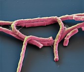 Anthrax bacteria, SEM