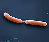 Burkholderi Teilung3  35kx - Bakterien, Burkholderi pseudomallei in Teilung 35 000-1