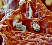 Alveolarmacroph Schw 2500x - Alveolarmacrophage an den Wandungen der Lungenbläschen, 2500-1