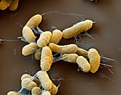 Plague bacteria, Yersinia pestis, SEM