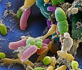 Faecal bacteria, SEM