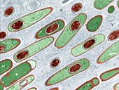 Bacillus anthracis, Milzbrand 14 000:1