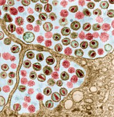 HIV mit Zellen 64kx - Human Immunodeficiency Virus 64 000-1