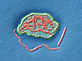 Measles virus particle, TEM