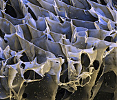 Spider silk from bacteria, SEM