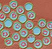 Herpes simplex virus particles, TEM