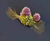 Cancer immunotherapy, SEM