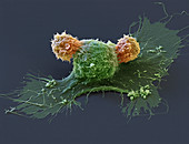 Cancer immunotherapy, SEM