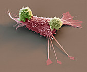 Cancer immunotherapy, SEM